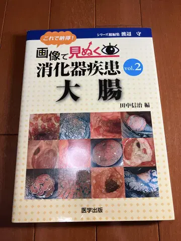 이미지로 보는 소화기 질환 vol.2 대장