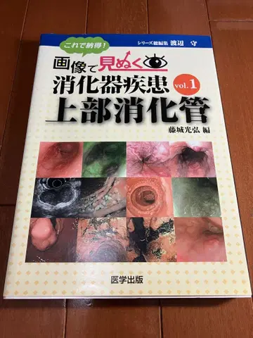 이미지로 보는 소화기 질환 vol.1 상부 소화관