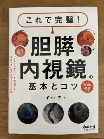 이제 완벽합니다! 담즙췌장 내시경의 기본과 요령