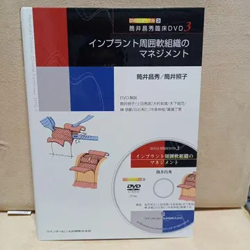임플란트 주변 연조직의 관리