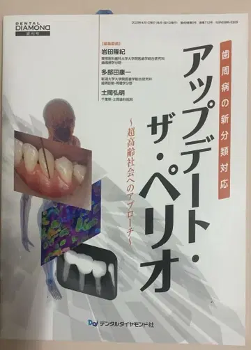 업데이트 더 페리오