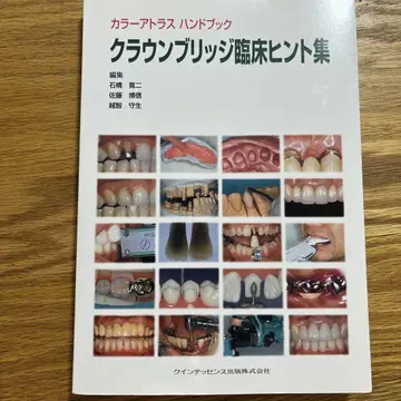 크라운 브릿지 임상 힌트 모음