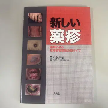 새로운 약발진 약물에 의한 피부 이상 반응의 새로운 타입