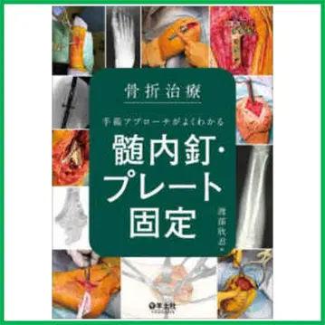 골절 치료 수술 접근법을 잘 알 수 있는 골수 내 못 및 플레이트 고정