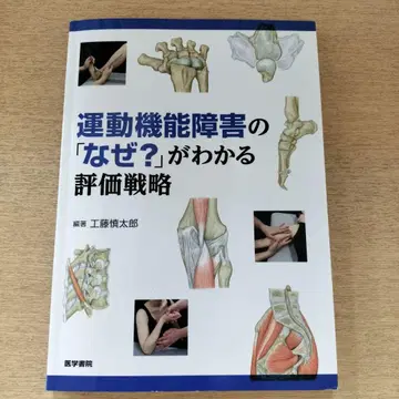 운동 기능 장애의 '왜?'를 이해하는 평가 전략