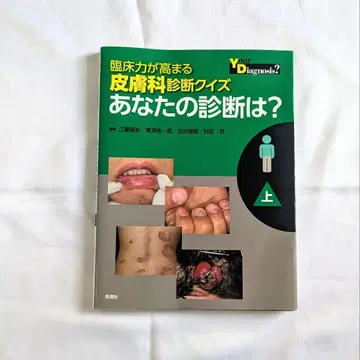 임상력이 향상되는 피부과 진단 퀴즈 당신의 진단은? 상