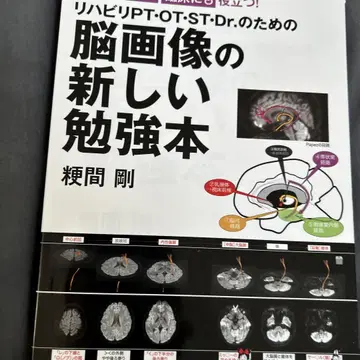 재활 PTOTSTDr를 위한 뇌 이미지 새로운 연구 도서