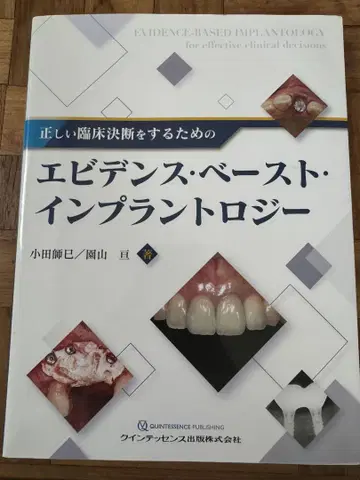 에비던스 베이스 임플란톨로지