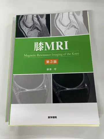 무릎 MRI 제3판