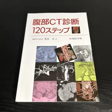 복부 CT 진단 120단계