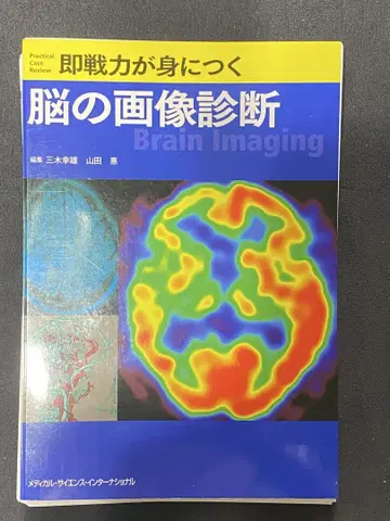 즉시 업무에 활용 가능한 뇌의 이미지 진단 Brain Imaging