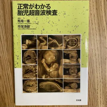 정상 여부를 알 수 있는 태아 초음파 검사