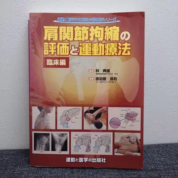 어깨 관절 구축의 평가와 운동 요법 임상편