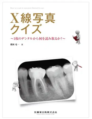 [재단 완료] X선 사진 퀴즈 - 덴탈 X선 판독법