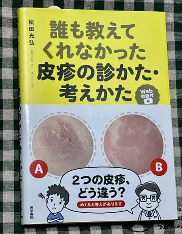 아무도 가르쳐주지 않았던 피진 진찰법, 사고방식 [Web 동영상 첨부]