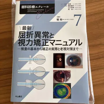 최신 굴절 이상과 시력 교정 매뉴얼 7