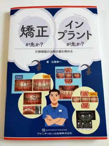 교정이 먼저인가? 임플란트가 먼저인가? 결손 보철의 치료 계획을 극복한다