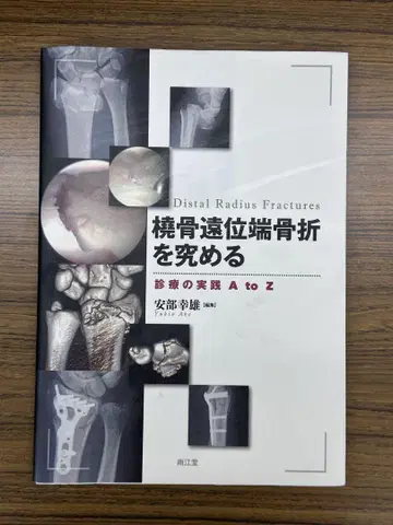 요골 원위단 골절을 궁구하는 진료의 실천 A to Z