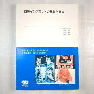 구강 임플란트의 기초와 임상