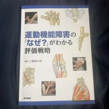 운동 기능 장애의 '왜?'를 이해하는 평가 전략