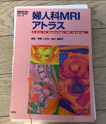 부인과 MRI 아틀라스