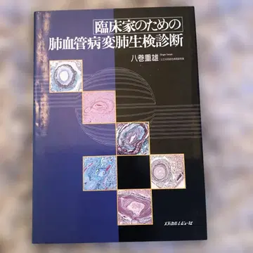 임상가를 위한 폐혈관 병변 폐생검 진단