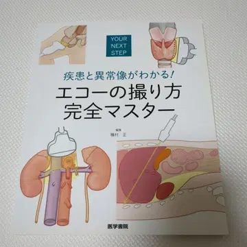 질환과 이상 소견을 알 수 있다! 에코 촬영법 완전 마스터