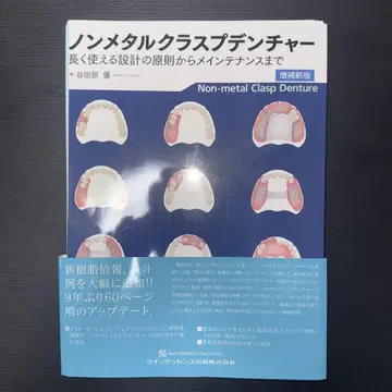 비메탈 클래스프 덴처