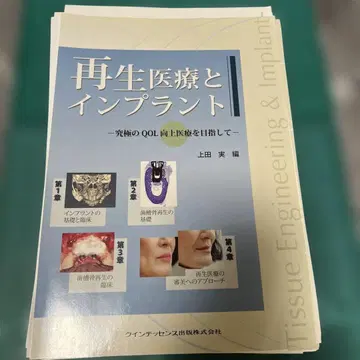 재생 의료와 임플란트 재단 완료