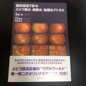 임상 경과로 보는 포도막염 망막염 공막염 아틀라스