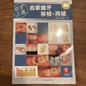 반드시 숙달, 자가 치아 이식, 재식
