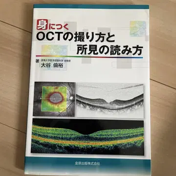 익히는 OCT 촬영법과 소견 판독법