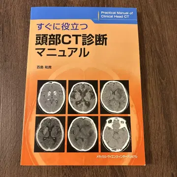 바로 활용 가능한 두부 CT 진단 매뉴얼