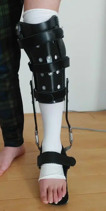 왼쪽 단하지 보조기