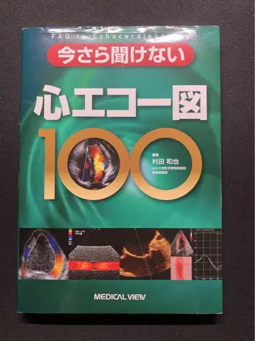 이제 와서 묻기 곤란한 심장 에코 그림 100