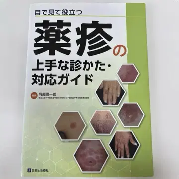 눈으로 보고 도움되는 약물 발진의 효과적인 진찰법 대응 가이드