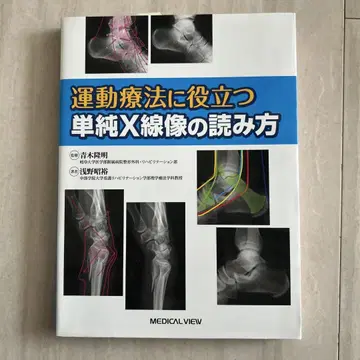 운동 요법에 도움이 되는 단순 X선 영상 판독법