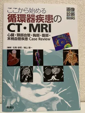 여기서 시작하는 순환기 질환의 CT MRI