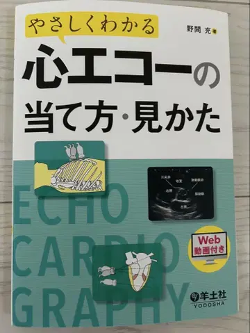 쉽게 알 수 있는 심장 에코 사용법, 보는 법
