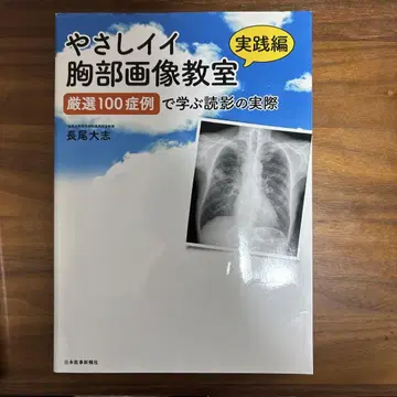 쉽고 좋은 흉부 영상 교실 실천편