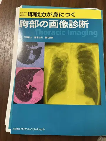 [재단] 즉시 전력이 되는 가슴 이미지 진단