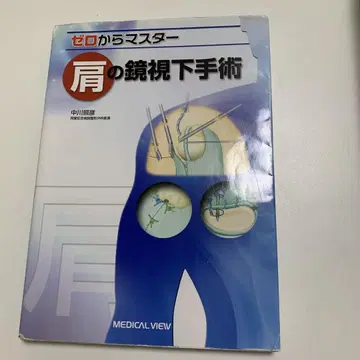 어깨 관절경 수술 : 제로부터 마스터