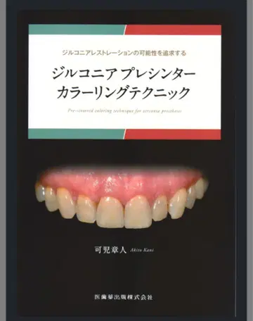지르코니아 프레싱 테크닉 컬러링 테크닉