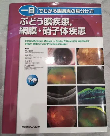 포도막 질환, 망막 유리체 질환 하권