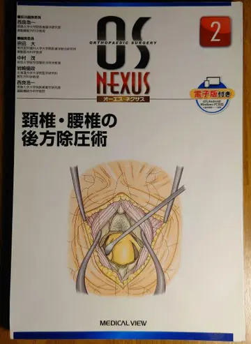 OS NEXUS 2 경추 요추 후방 감압술(절단됨)