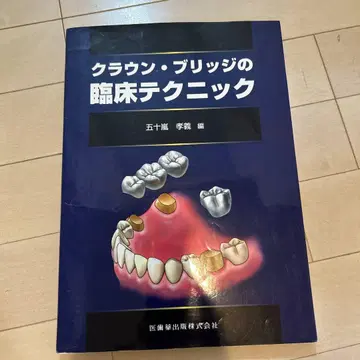 크라운 브릿지의 임상 테크닉
