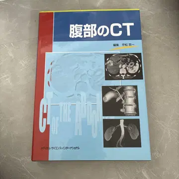 복부 CT