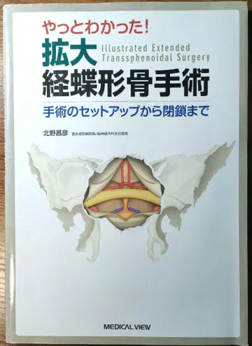 드디어 알았다! 확대 경접형골 수술 수술 셋업부터 봉합까지
