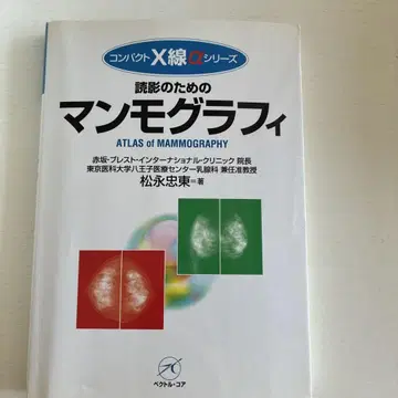 판독을 위한 유방 촬영술