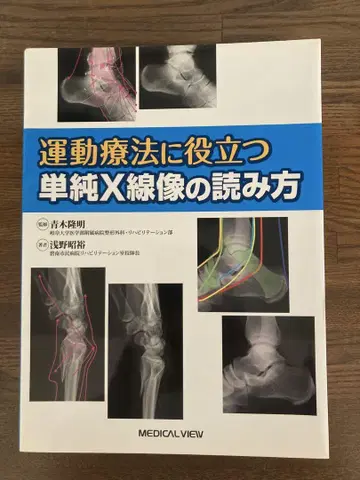 운동 요법에 도움이 되는 단순 X선 영상 판독법
